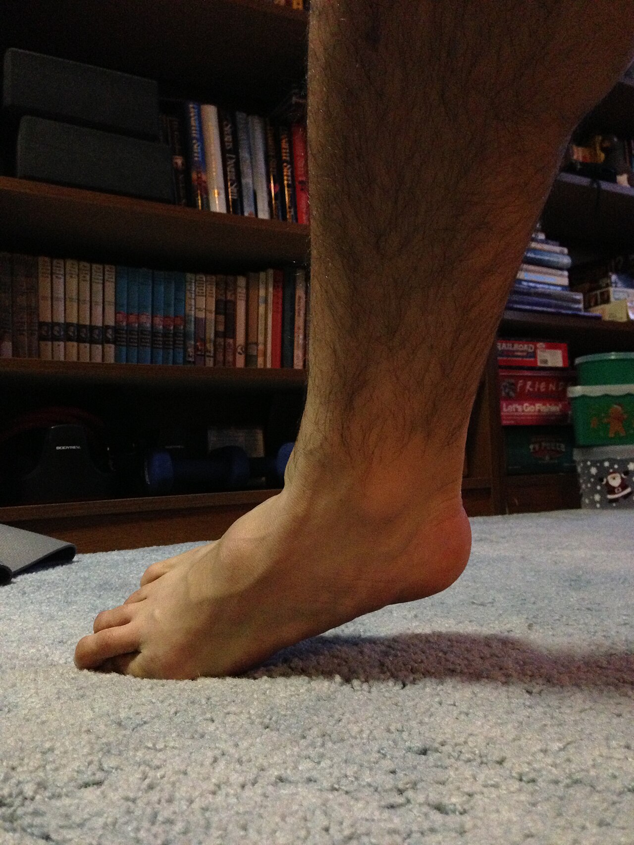 Ankle fracture
