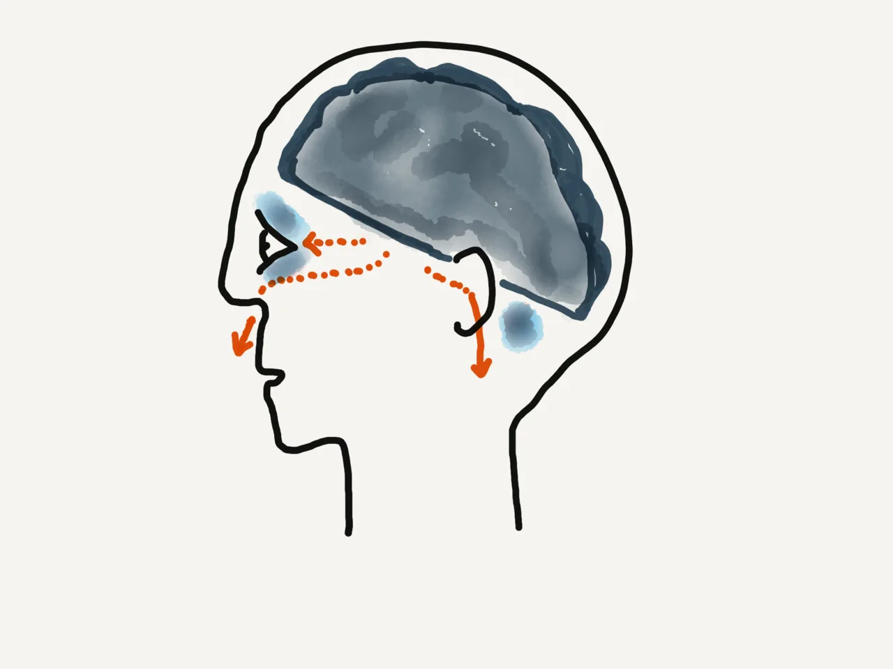 Basilar skull fracture