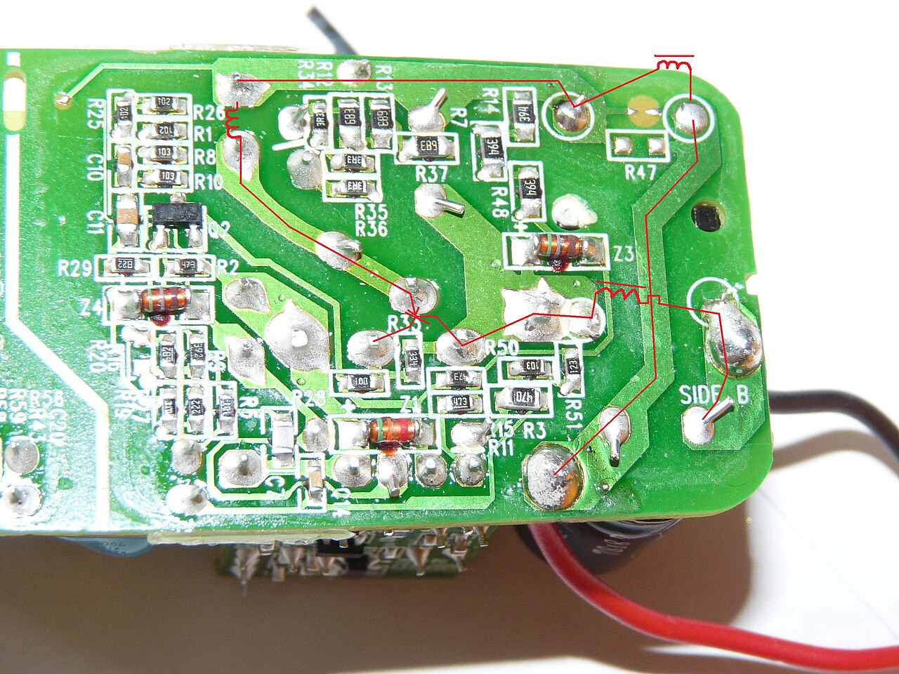 Electrical burn
