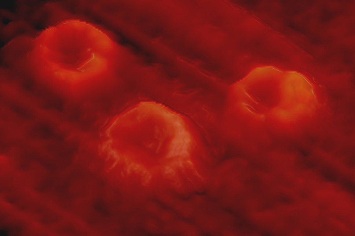 Blood Follows