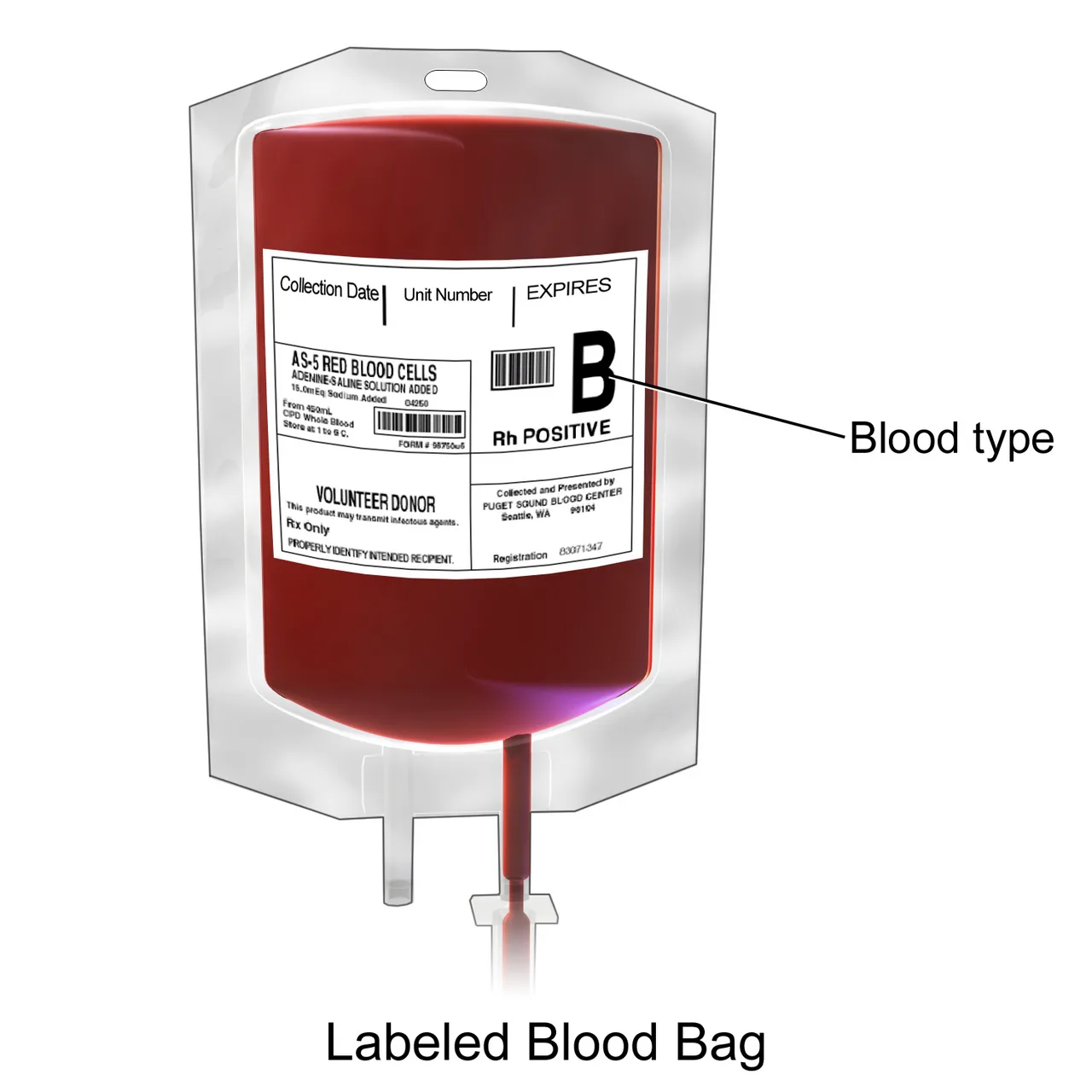 Blood Follows