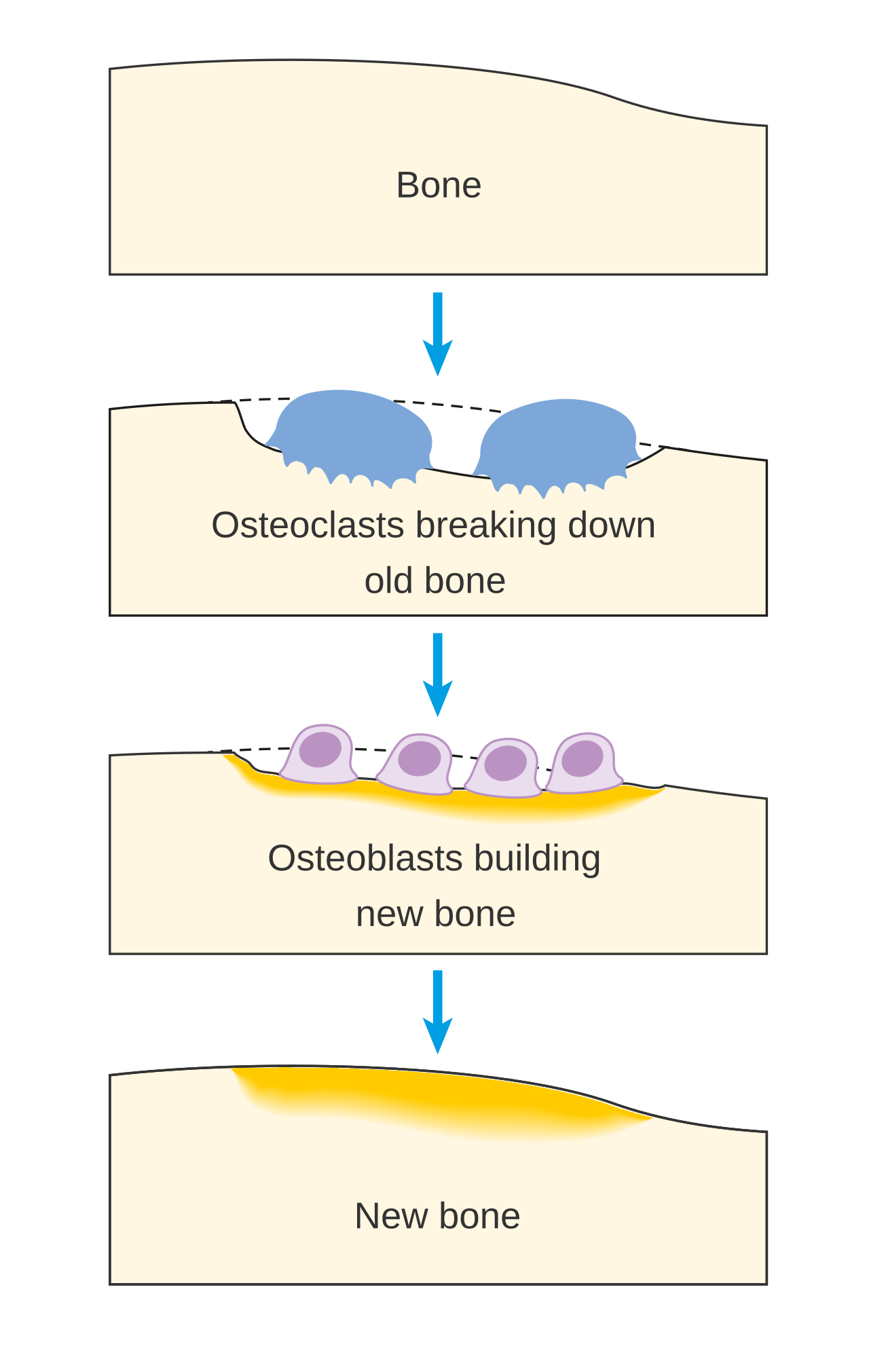 Bone Cancer Research Trust