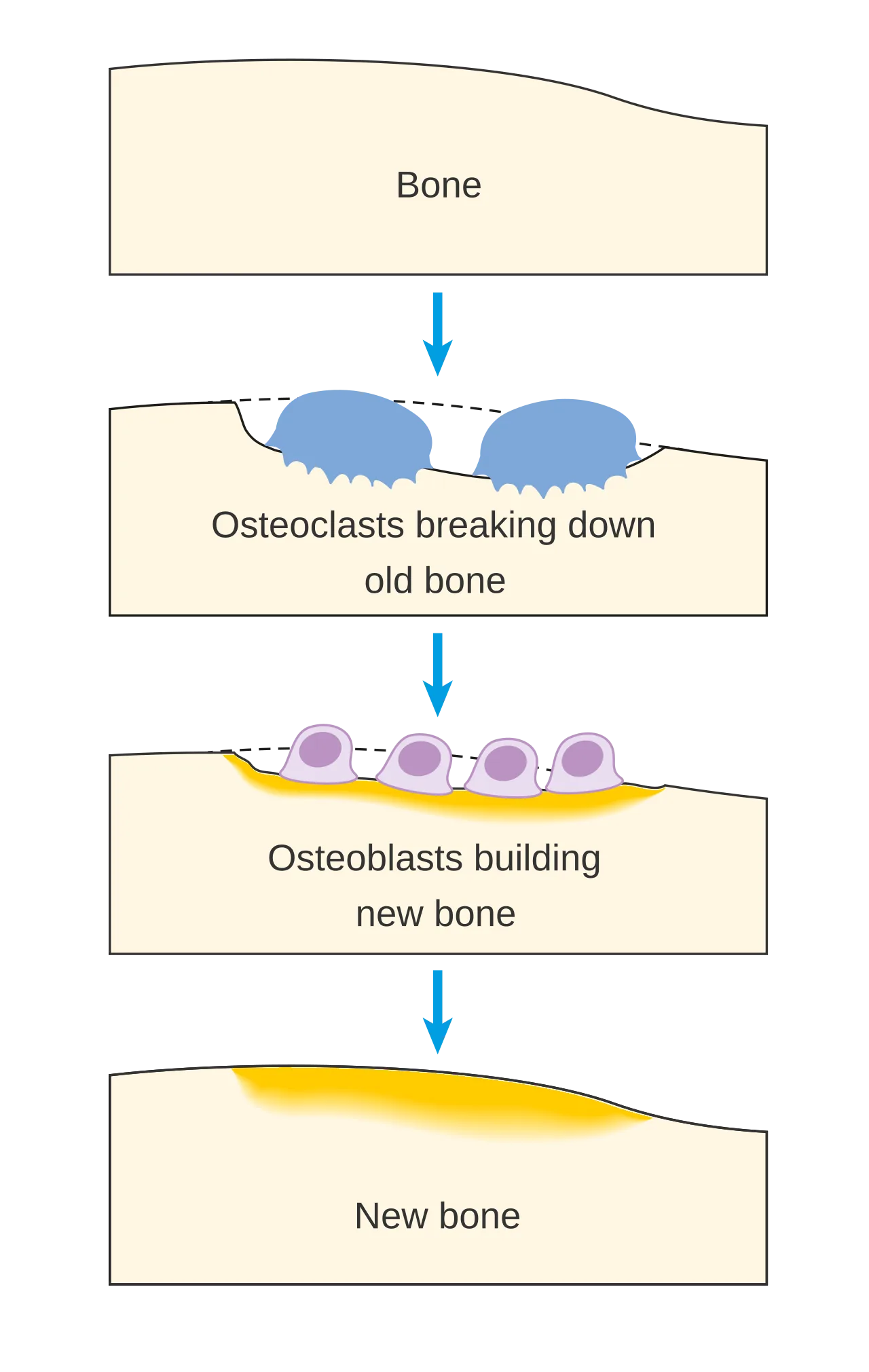 Bone Cancer Research Trust
