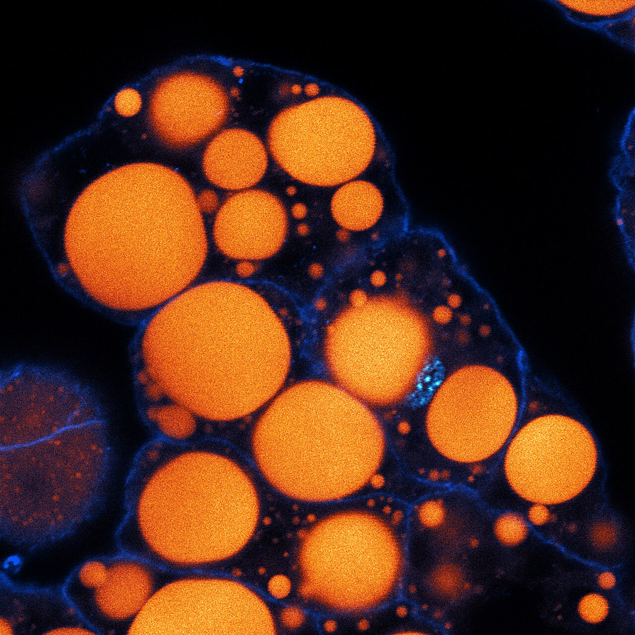 Lipid