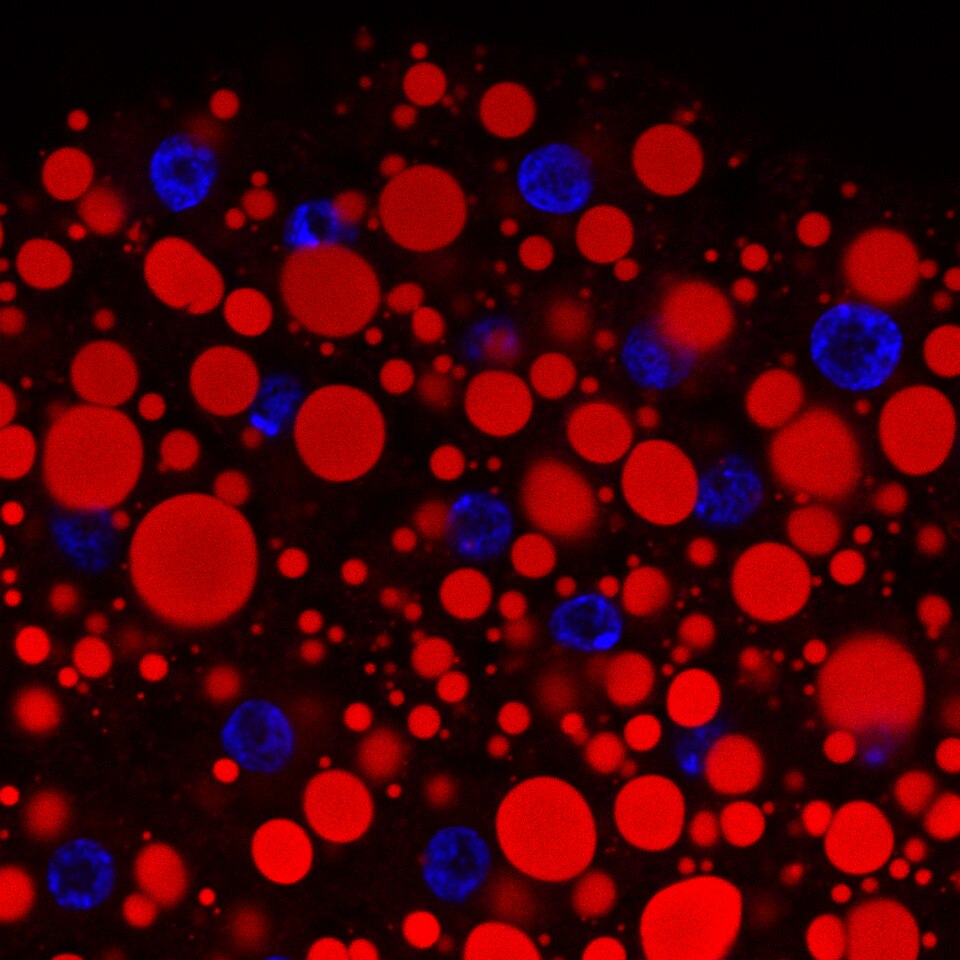 Lipid