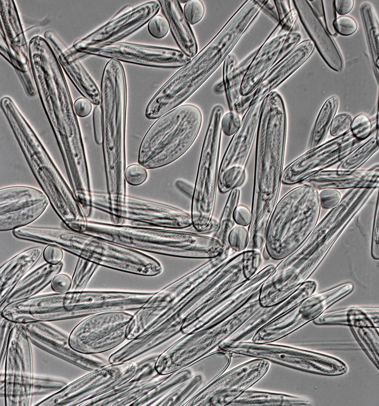 Chironex fleckeri