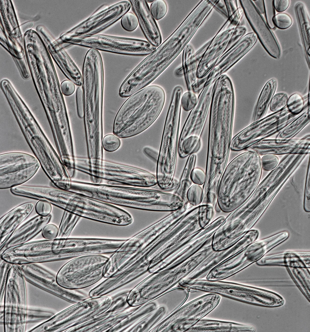 Chironex fleckeri