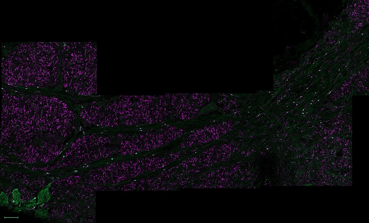 Mouse tracking