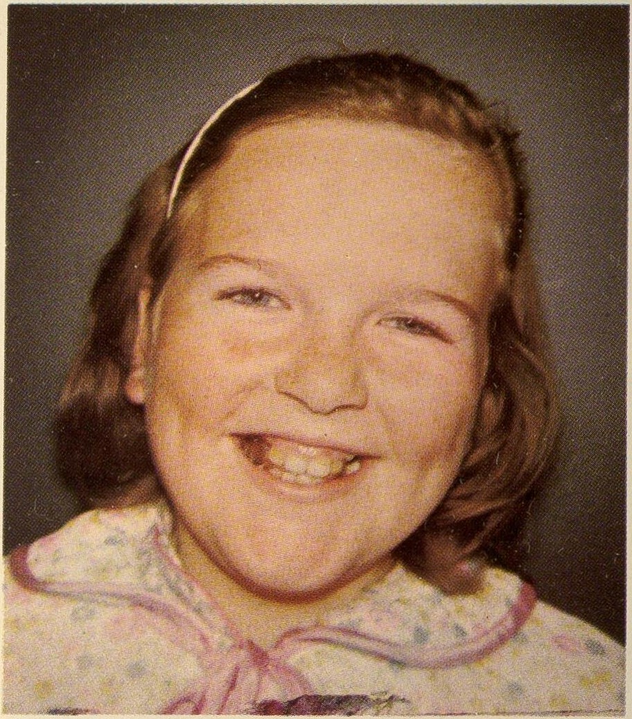 Albright's hereditary osteodystrophy