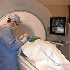 Brain tumor