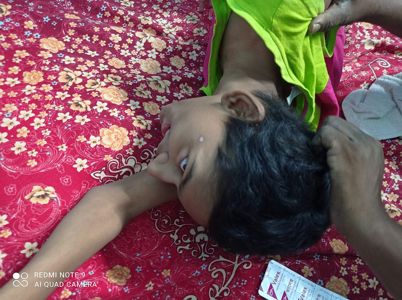 Cerebral palsy