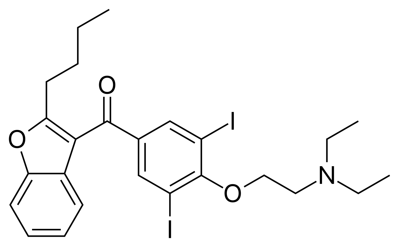Amiodarone induced thyrotoxicosis