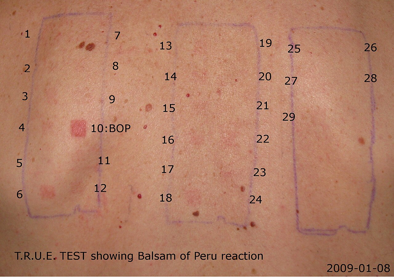 Balsam of Peru