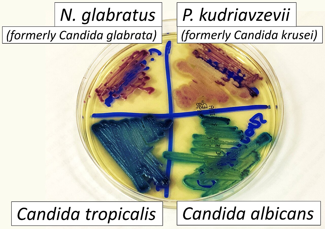 CHROMAgar with N glabratus, P kudriavzevii, Candida albicans and Candida tropicalis, annotated