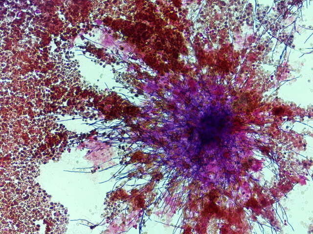 Candida albicans