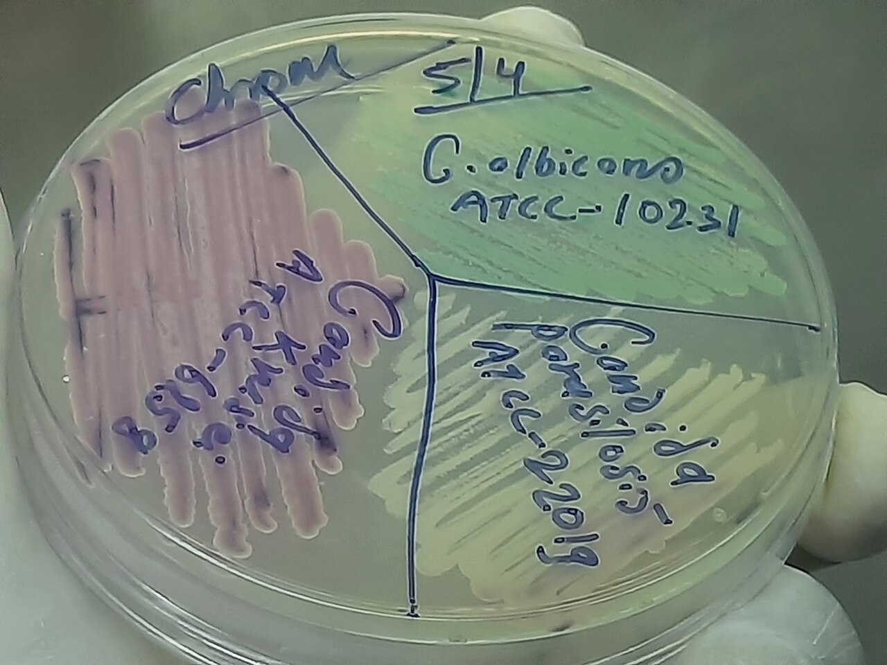 Candida albicans