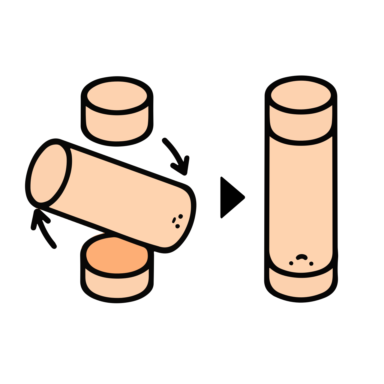 Chromosome abnormality
