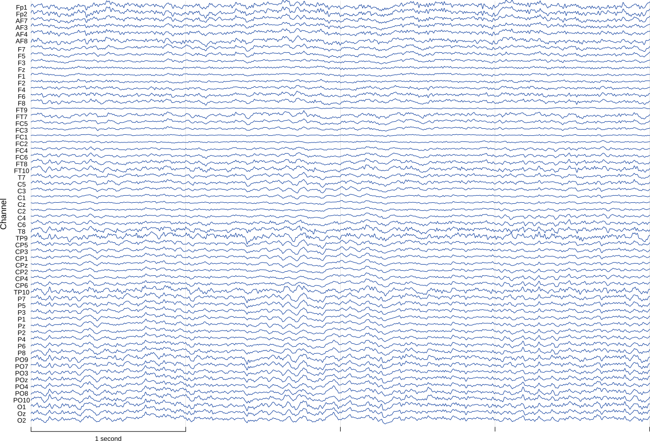 Time series