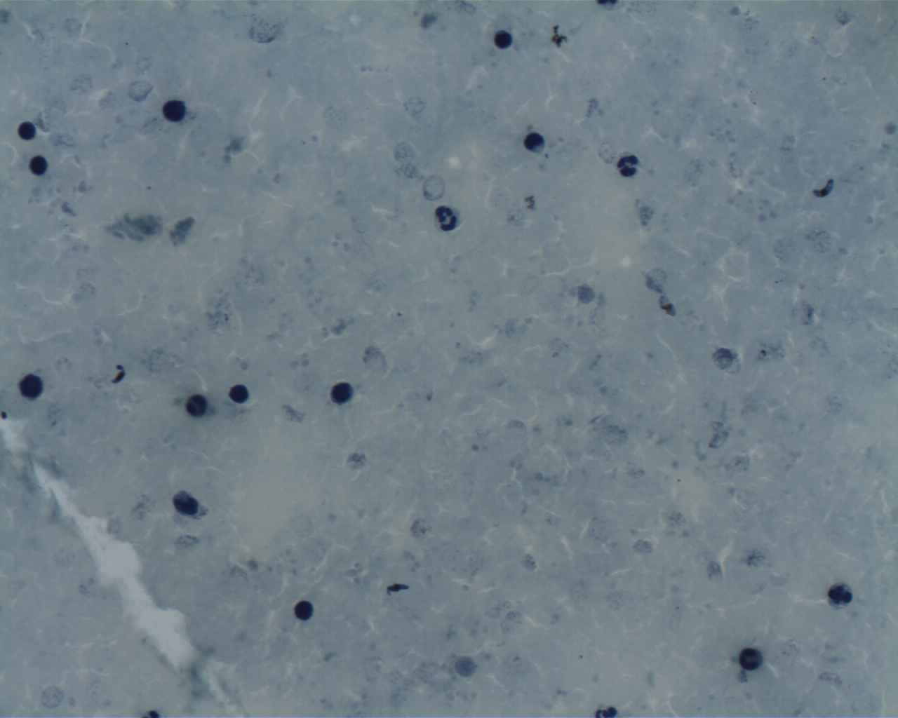 Plasmodium