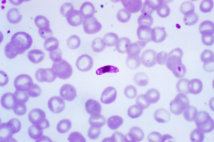 Plasmodium