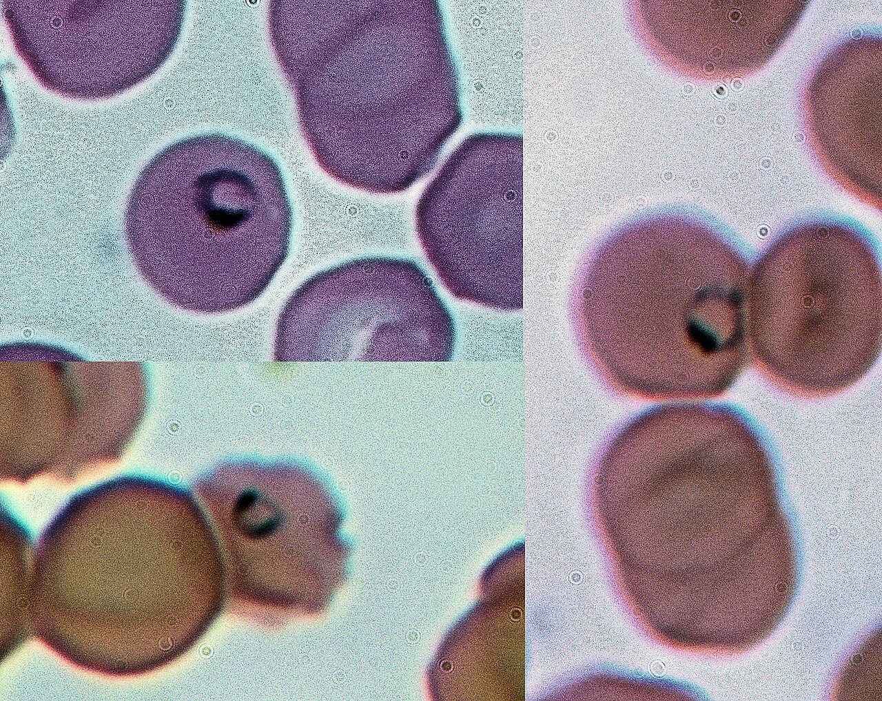 Plasmodium