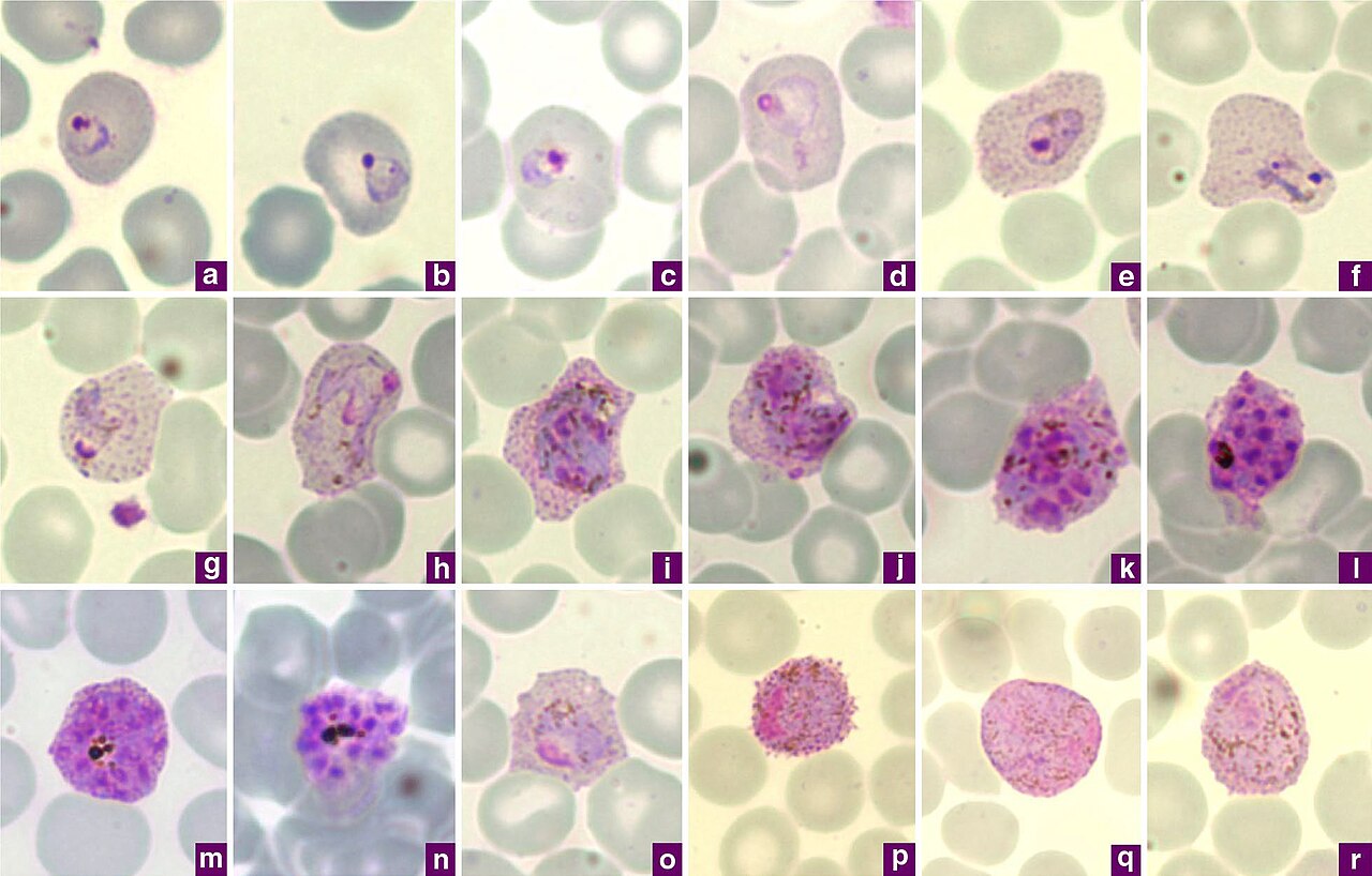 Plasmodium