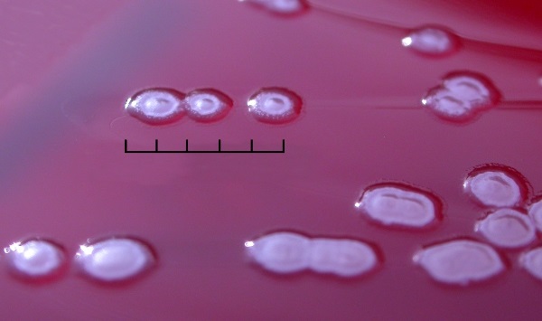 Pseudomonas aeruginosa