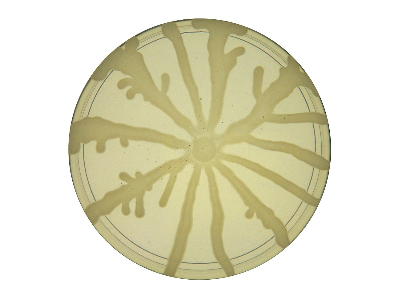 Pseudomonas aeruginosa