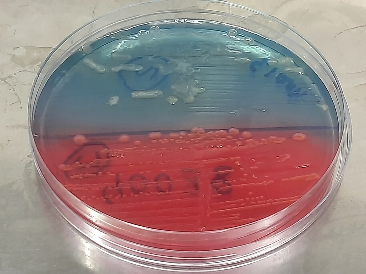 Pseudomonas aeruginosa