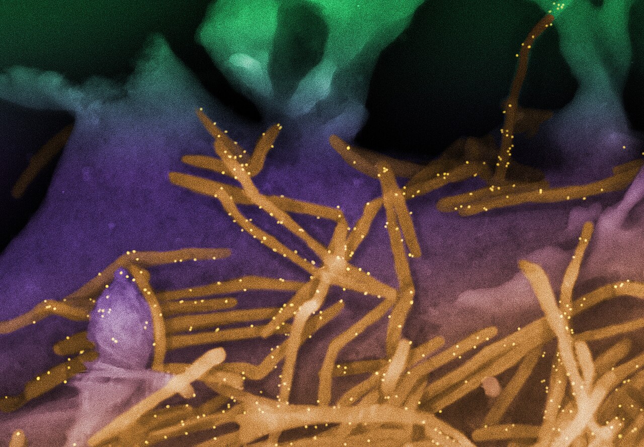 Respiratory syncytial virus