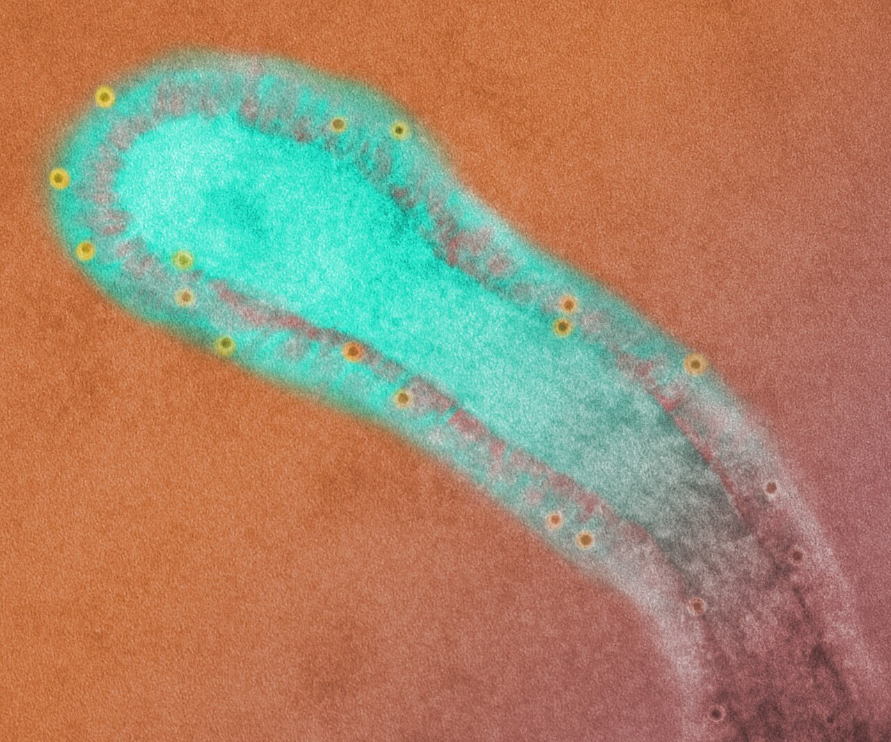 Respiratory syncytial virus