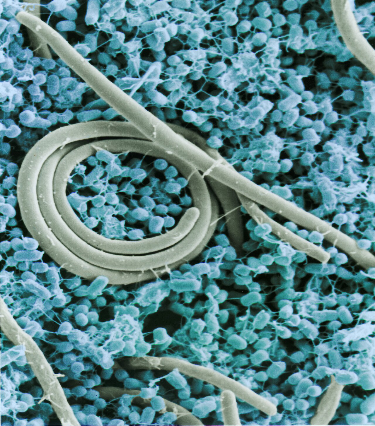 Salmonella enterica