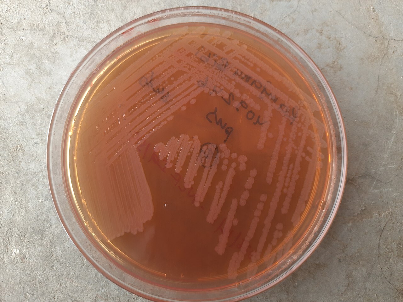 Salmonella enterica