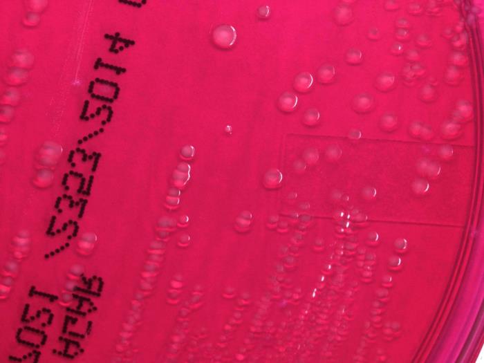 Shigella