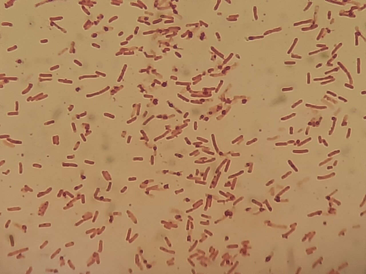 Shigella