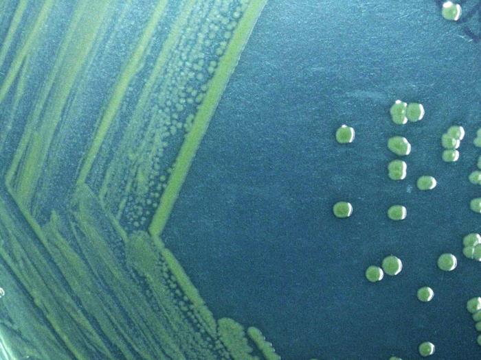 Shigella