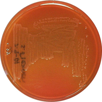 Shigella