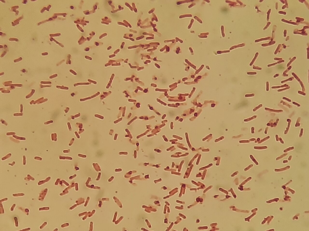 Shigella