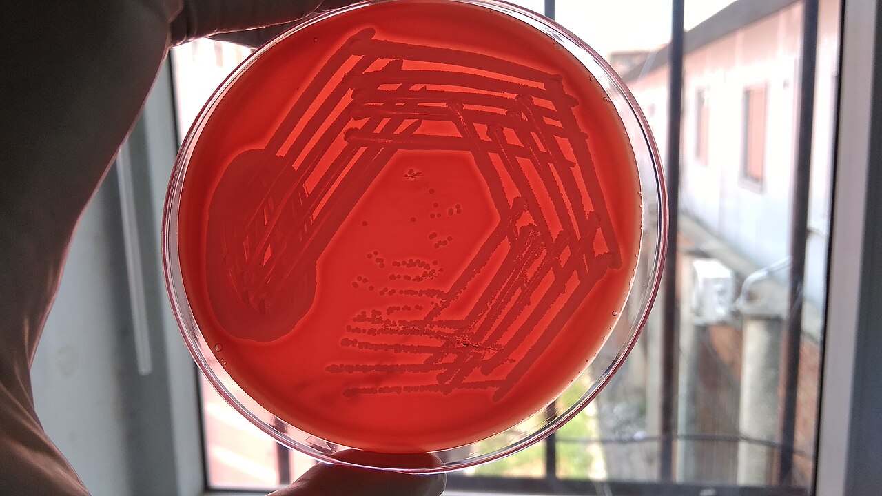 Staphylococcus aureus