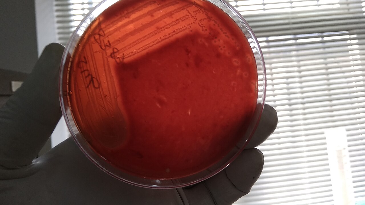 Staphylococcus aureus