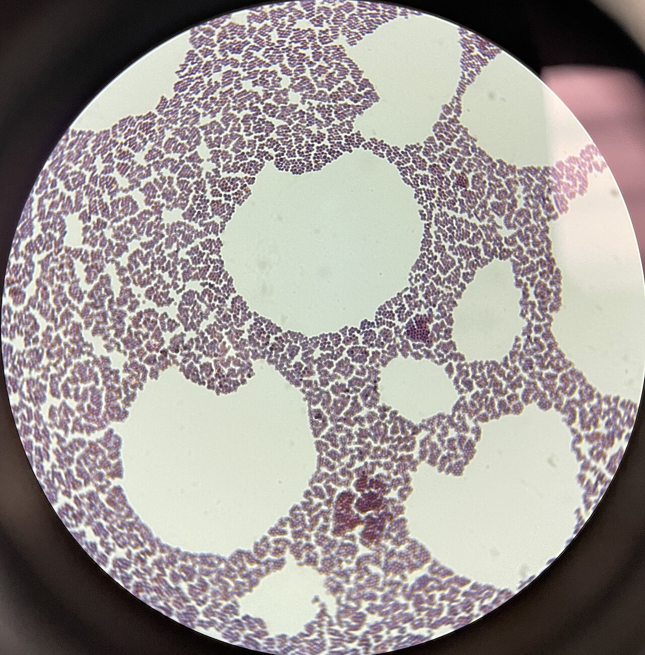 Staphylococcus