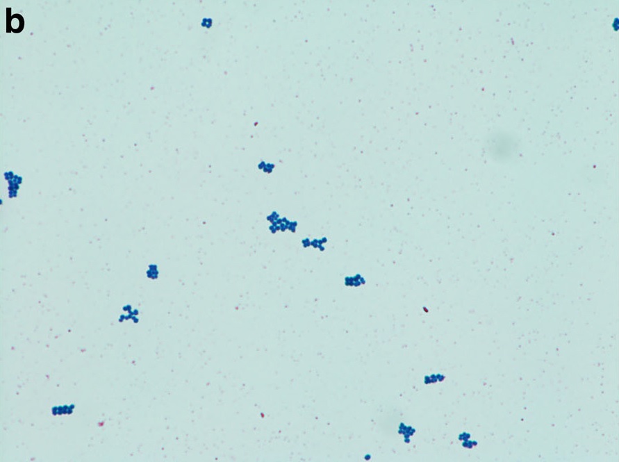 Staphylococcus