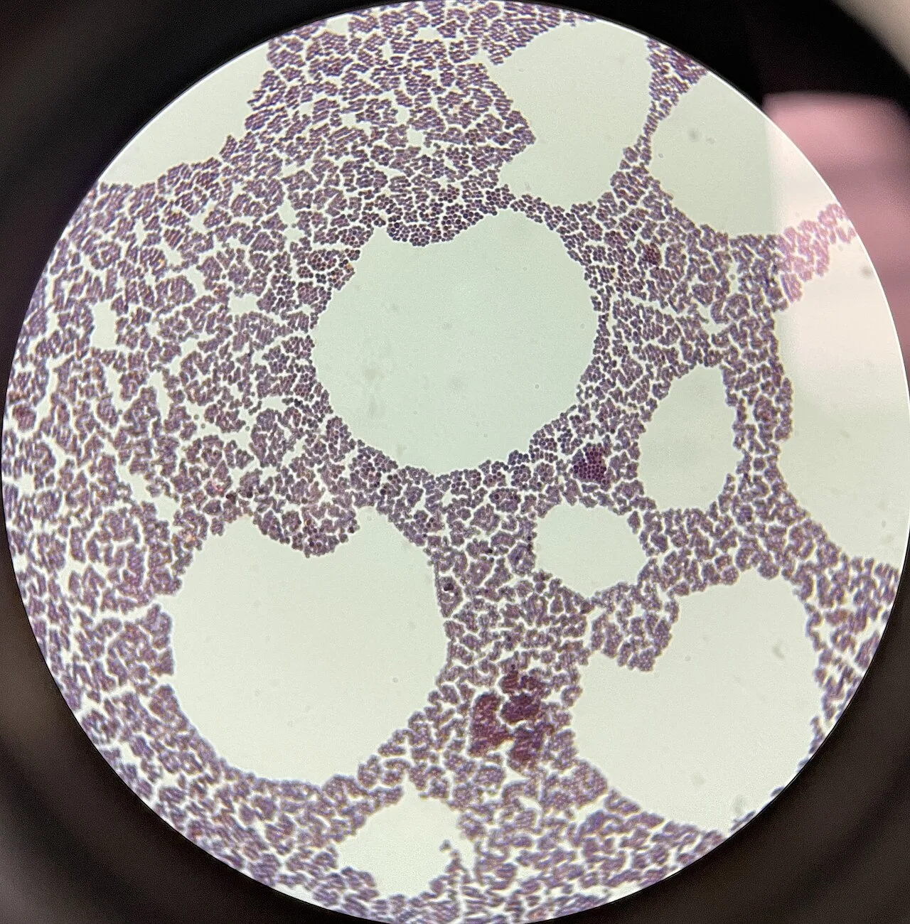 Staphylococcus