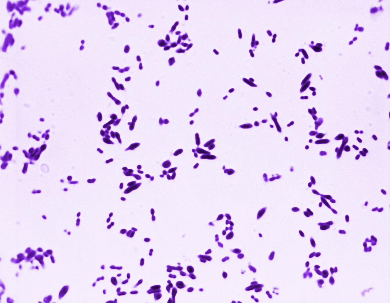 Streptococcus