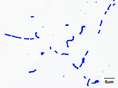 Streptococcus