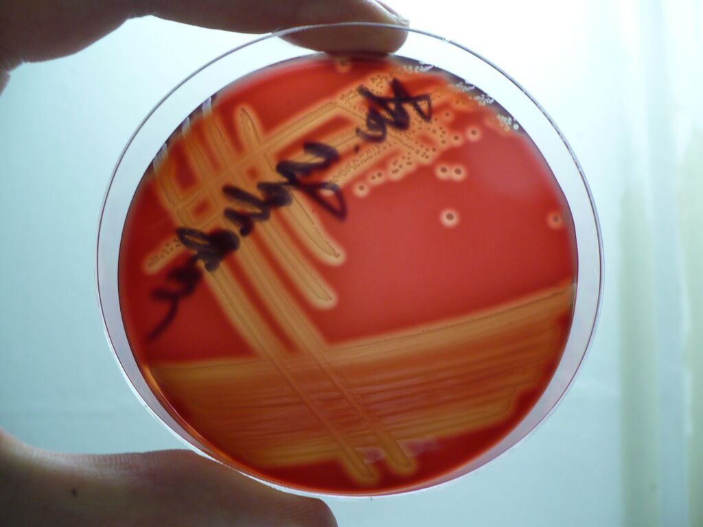 Streptococcus
