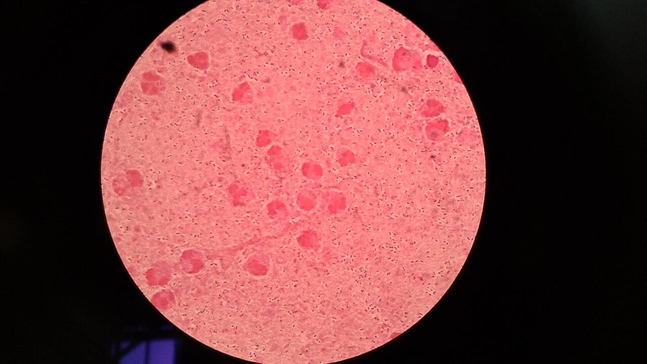Streptococcus pneumoniae