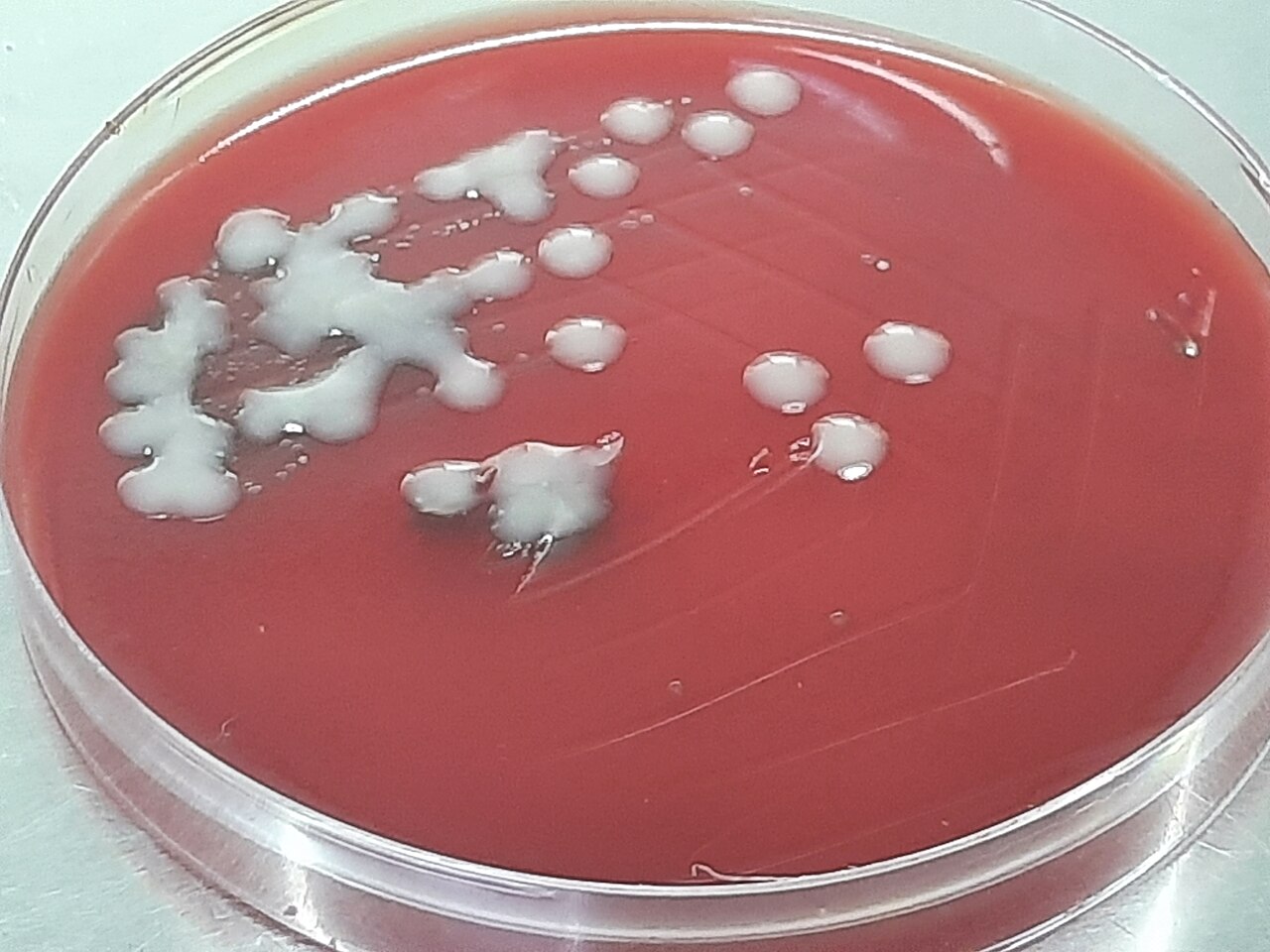 Streptococcus pneumoniae