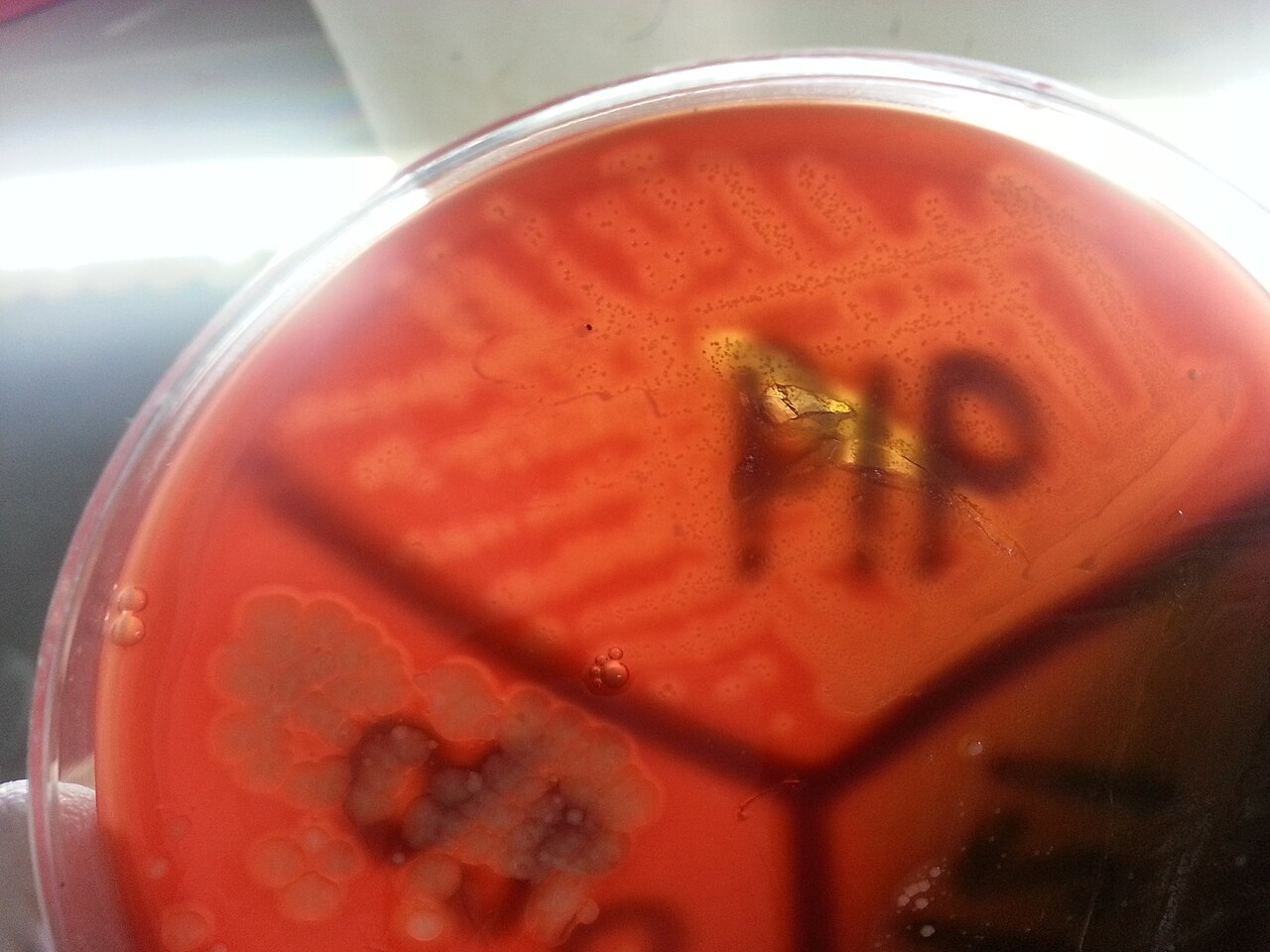Streptococcus pyogenes