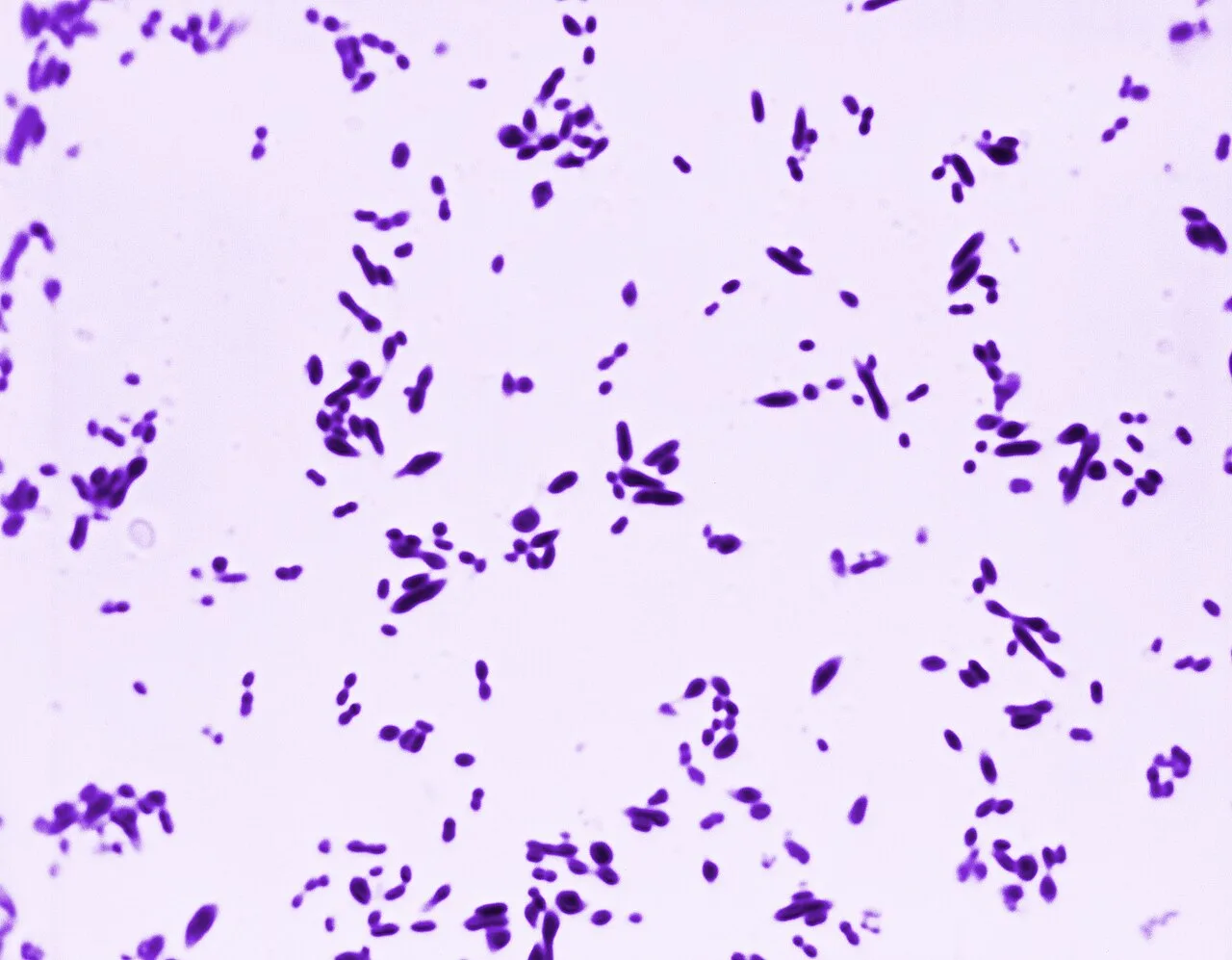 Streptococcus